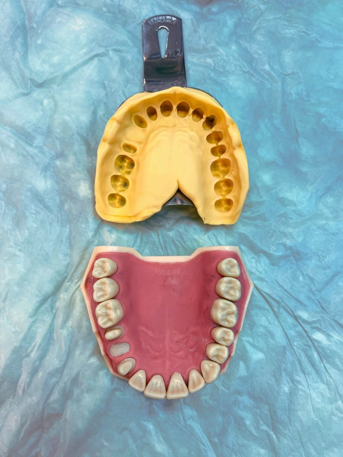 a plastic model of a mouth and a plastic model of a mouth