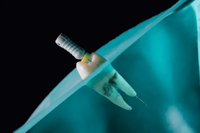 a close-up of a white praying mantis